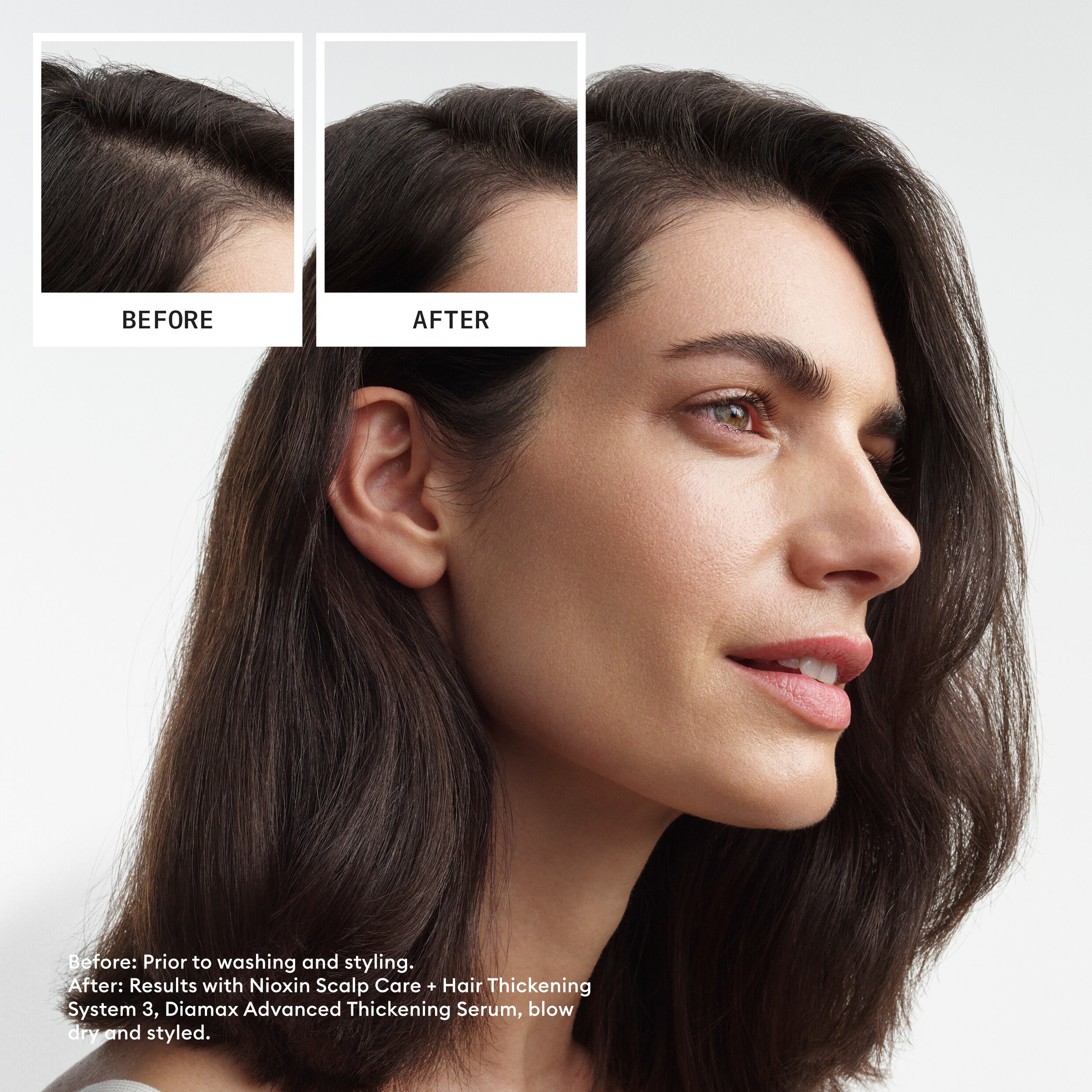 Nioxin Scalp  + Hair Thickening System 3 - Includes Shampoo, Conditioner and Scalp Treatment