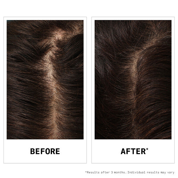 Nioxin Hair Fall Defense Shampoo